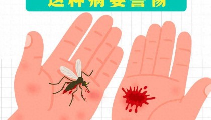 突发疫情！该地多镇街通知：一起点蚊香